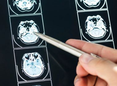 El cerebro emite ondas que pueden ser captadas por un escáner.