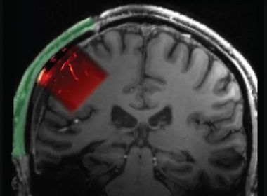 cerebro ventana