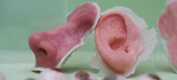 3d-printed-nose-and-ears