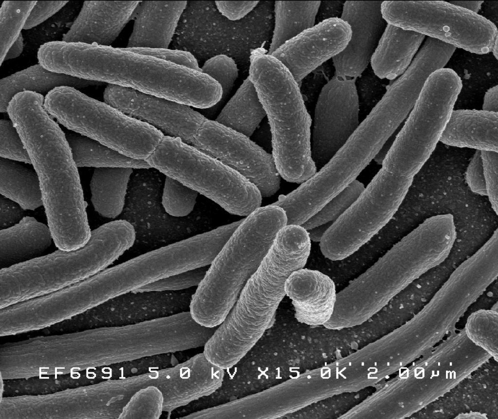 Escherichia Coli bacteria microscopio